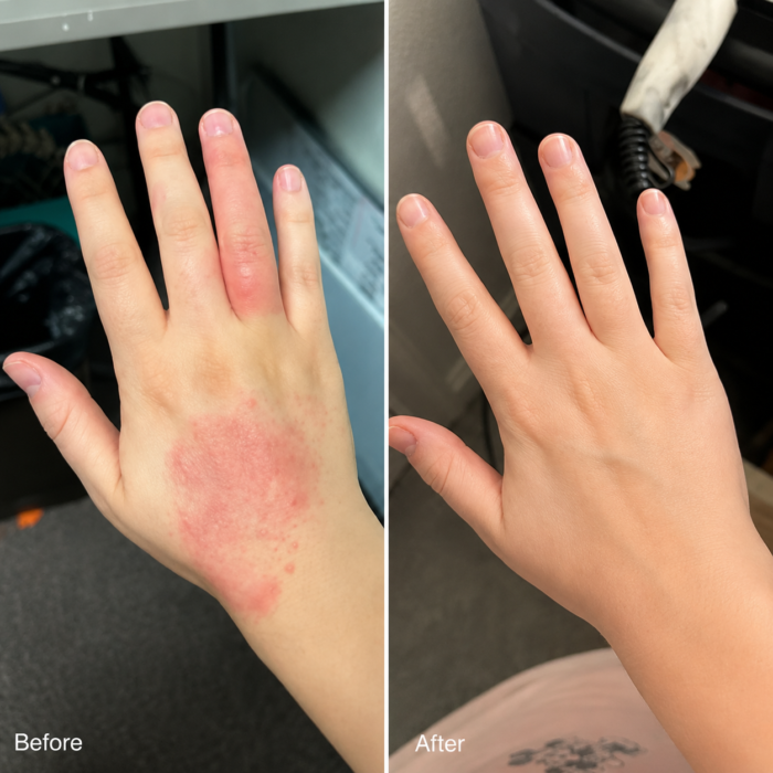 Ihon tulehdukseen & Terve iho – Lieventää kutinaa, punoitusta ja hilseilyä 50ml - Image 9